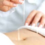 acupuncture-images-for-ivf-150x150 TMJ treatment Cairns