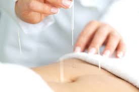 acupuncture-images-for-ivf Acupuncture Back Pain Cairns