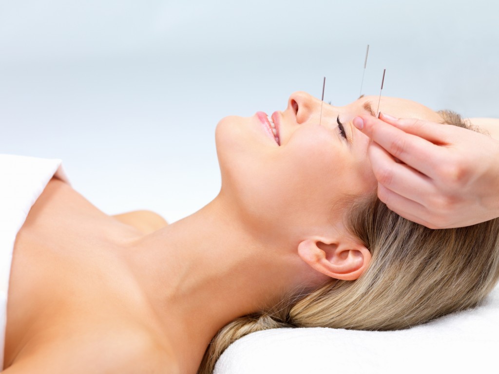 Acupuncture-face-lift-1024x768 Acupuncture for Stress Cairns