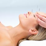 Acupuncture-face-lift-150x150 Acupuncture Migraine Cairns