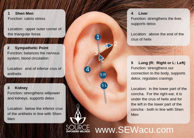 NADA-Ear-detox-pic Acupuncture for Detoxification Cairns