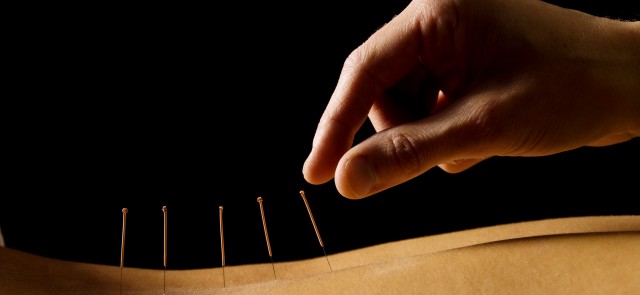 acupuncture practitioners cairns