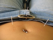 Acupuncture-for-infertility Acupuncture Digestive problems Cairns