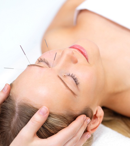 acupuncture2222 Cairns Deep Tissue Massage